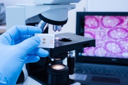 Coleta de Material para Anatomia Patológica